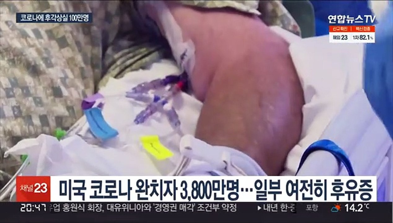 "코로나 완치 뒤에도 후각 상실, 미국서 최소 100만명"