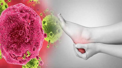 आपके पैरों में भी होती है जलन तो हो जाएं सावधान इस गंभीर बीमारी का लक्षण | Boldsky