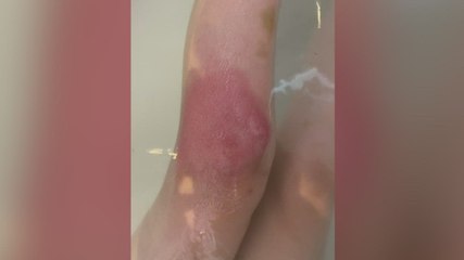 Medway residents plea after mosquitoes take over their village