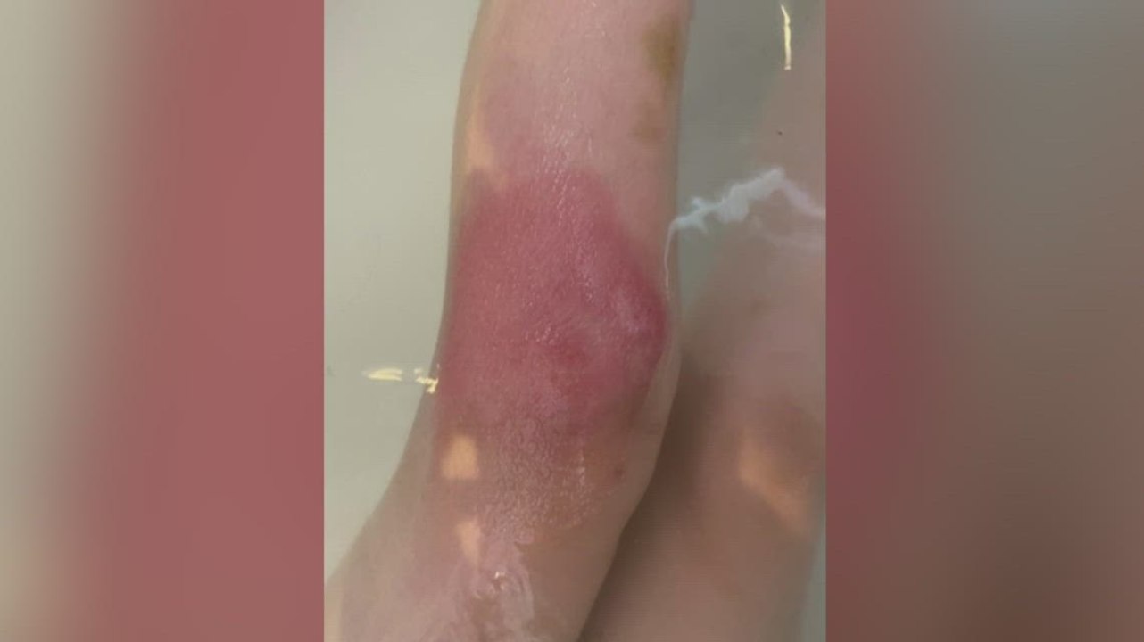 Medway residents plea after mosquitoes take over their village