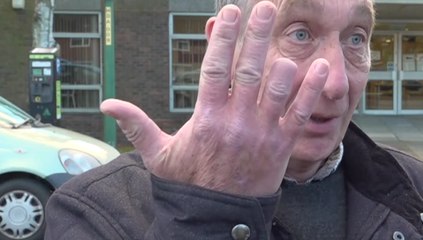 Dog owner found guilty after pet bites off part of postmans finger