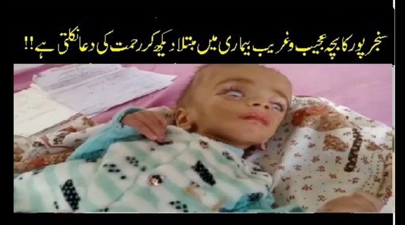 Sanjarpur kay Bachay ko ajeeb o gareeb bemari waldain preshan | Indus Plus News Tv