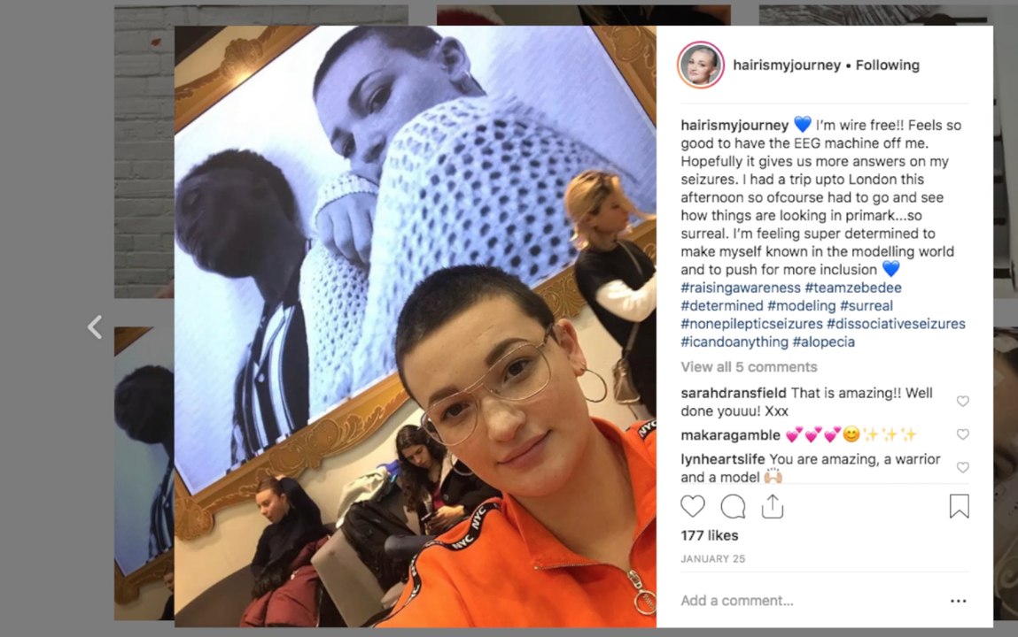 Tonbridge Primark model inspires diversity after losing her hair