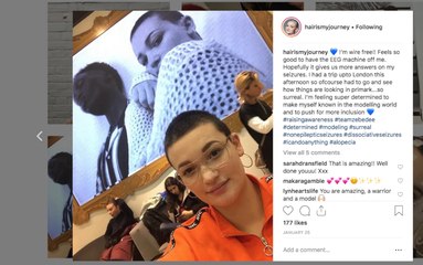 Tonbridge Primark model inspires diversity after losing her hair