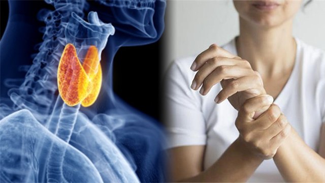 सोते समय हाथ दर्द Carpel Tunnel Syndrome का Symptom, Thyroid की जांच जरूरी | Boldsky