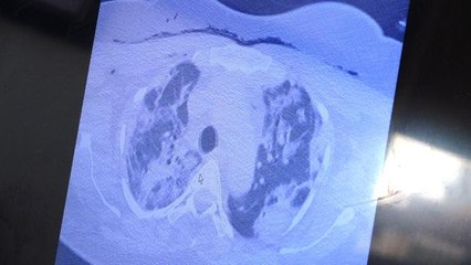 Prof. Dr. Özkaya: "Virüs artık akıllı bir organizma gibi davranıyor"