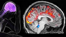 नाक से सफेद पानी निकलना Brain Tumor का Symptom, Cerebrospinal Fluid क्या है | Boldsky