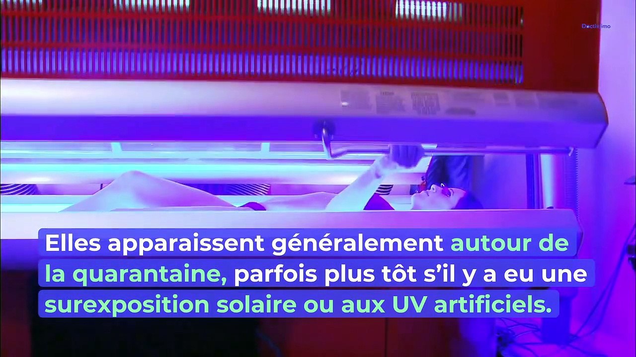 Comment enlever les taches brunes ?