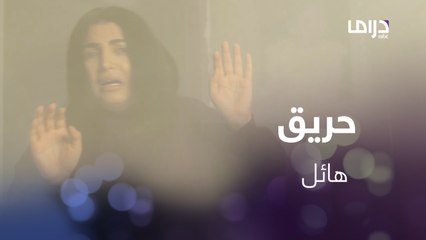 حريق يشب بمنزل ليال..وإصابات بالغة تصيبها