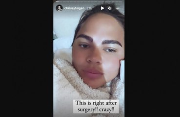 Chrissy Teigen se ha sometido a un trasplante de cejas