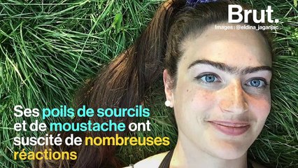 Elle a arrêté de s'épiler les poils du visage