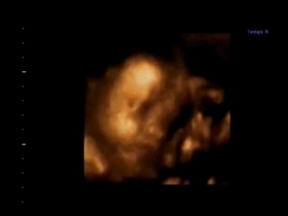 echo 3d benoit junior