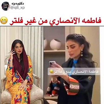 فاطمة الأنصاري بملامح مختلفة تصدم المتابعين
