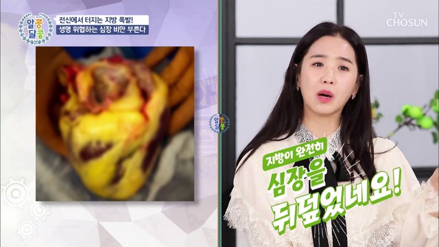 지방의 폭발을 방치하면 나타나는 다양한 질환 TV CHOSUN 20211125 방송