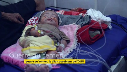 Yémen : le conflit a fait 377 000 morts