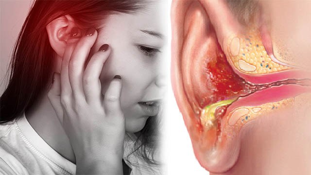 कान बहने का क्या कारण है, कान की हड्डी सड़ने से लेकर Tumor तक का Symptom | Boldsky