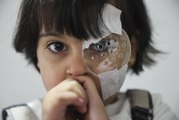 Son dakika: Suriyeli 3 yaşındaki çocuk, iki gözüne yapılan kornea nakliyle karanlıktan kurtuldu