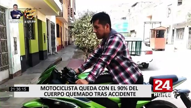 Padres de motociclista que resultó con quemaduras tras choque en carretera piden ayuda