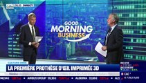 Culture Geek : La première prothèse d’œil imprimée 3D, par Frédéric Simottel - 29/11