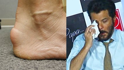 Anil Kapoor 11 साल से Achilles Tendinitis बीमारी के शिकार,Symptoms और कारण चौका देंगे । Boldsky