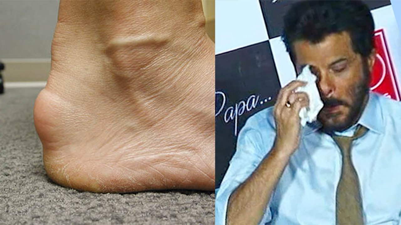 Anil Kapoor 11 साल से Achilles Tendinitis बीमारी के शिकार,Symptoms और कारण चौका देंगे । Boldsky