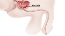 bd-la-fisioterapia-antes-y-despues-de-una-cirugia-de-prostata-291121