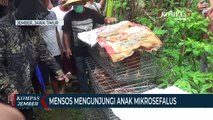 Menteri Sosial Risma Berkunjung ke Kakak Beradik Penderita Mikrosefalus di Jember
