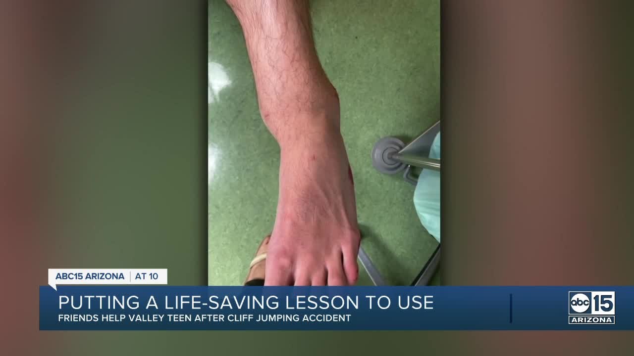Valley teens use 'Stop the Bleed' training after friend breaks legs cliff jumping