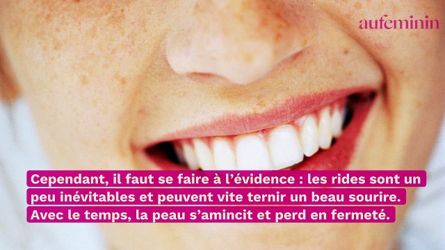 Rides autour de la bouche : tout pour les éviter et les atténuer !