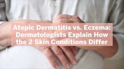 Download Video: Atopic Dermatitis vs. Eczema: Dermatologists Explain How the 2 Skin Conditions Differ