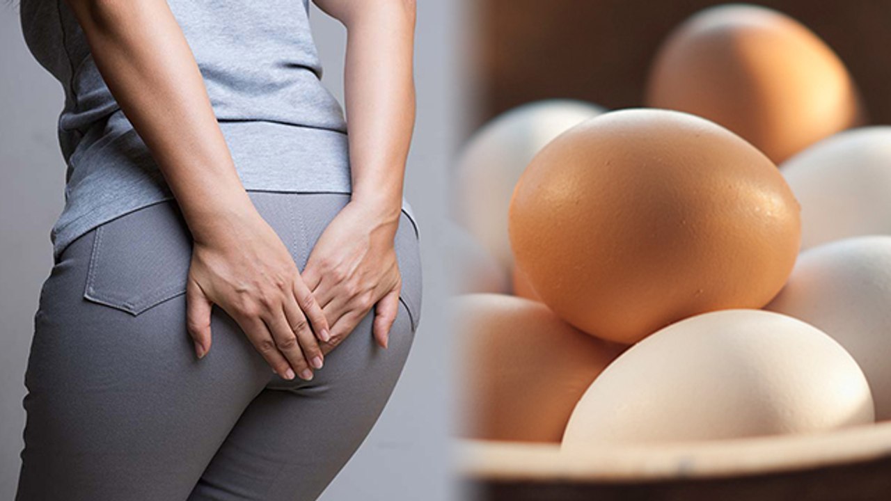 Piles में अंडा खाना चाहिए या नहीं? Piles में Egg खाने से क्या होता है । Expert Advice । Boldsky