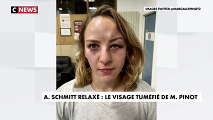 Alain Schmitt relaxé : Margaux Pinot dévoile son visage tuméfié