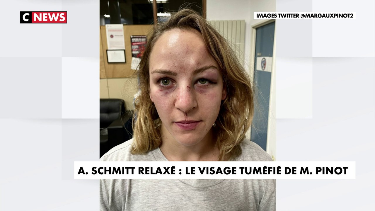 Alain Schmitt relaxé : Margaux Pinot dévoile son visage tuméfié