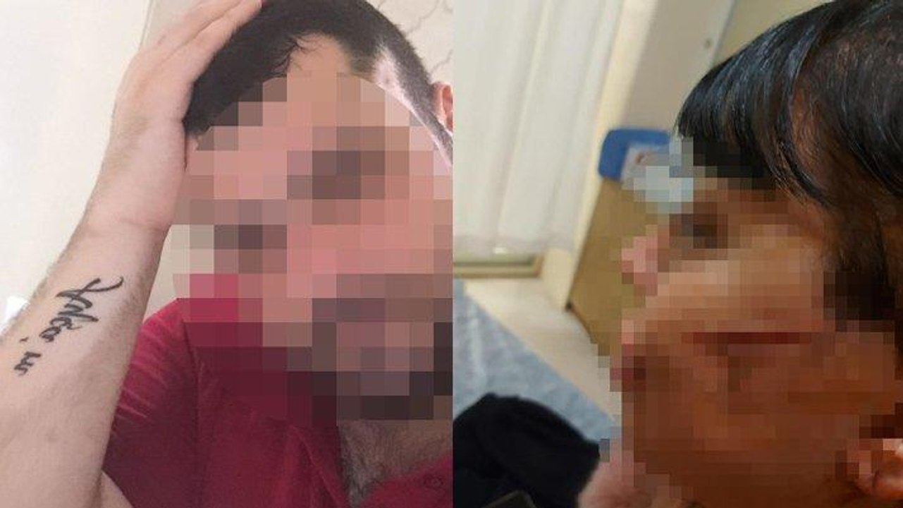 Kadına dehşeti yaşattı: Önce vuruldu, sonra yüzü kesildi