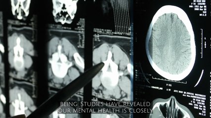 How Exercise Impacts Your Brain