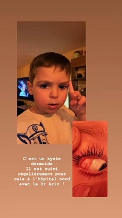 Ambre Dol de "Familles nombreuses" dévoile que son fils Joaquim a un petit problème à l'oeil