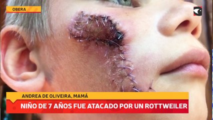 Un niño de 7 años fue atacado por un rottweiler