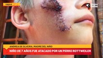 Niño de 7 años fue atacado por un perro rottweiler