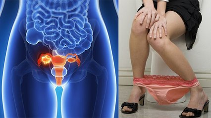 Ovarian Cancer से बचा सकते है Body के ये Symptoms, Doctors Alert | Boldsky