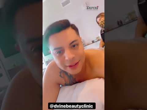 Eduin Caz sufre caída en el escenario en pleno concierto