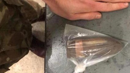 Hastaneye kaldırılan adamın makatından II. Dünya Savaşı'ndan kalma tanksavar mermisi çıkarıldı: Ayağım kaydı üstüne oturdum