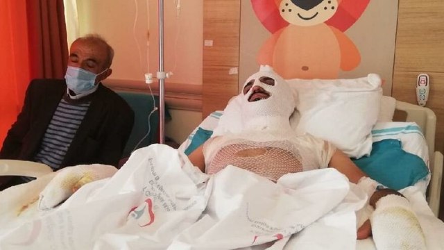 Isınmak için tenekeye tiner dökünce vücudu yandı