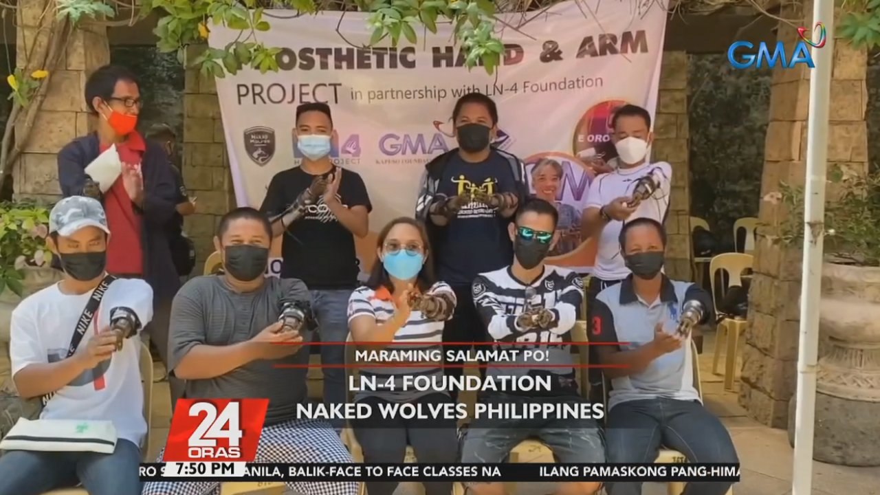 GMA Kapuso Foundation nagbigay ng libreng prosthetic hand and arm sa Cebu province | 24 Oras