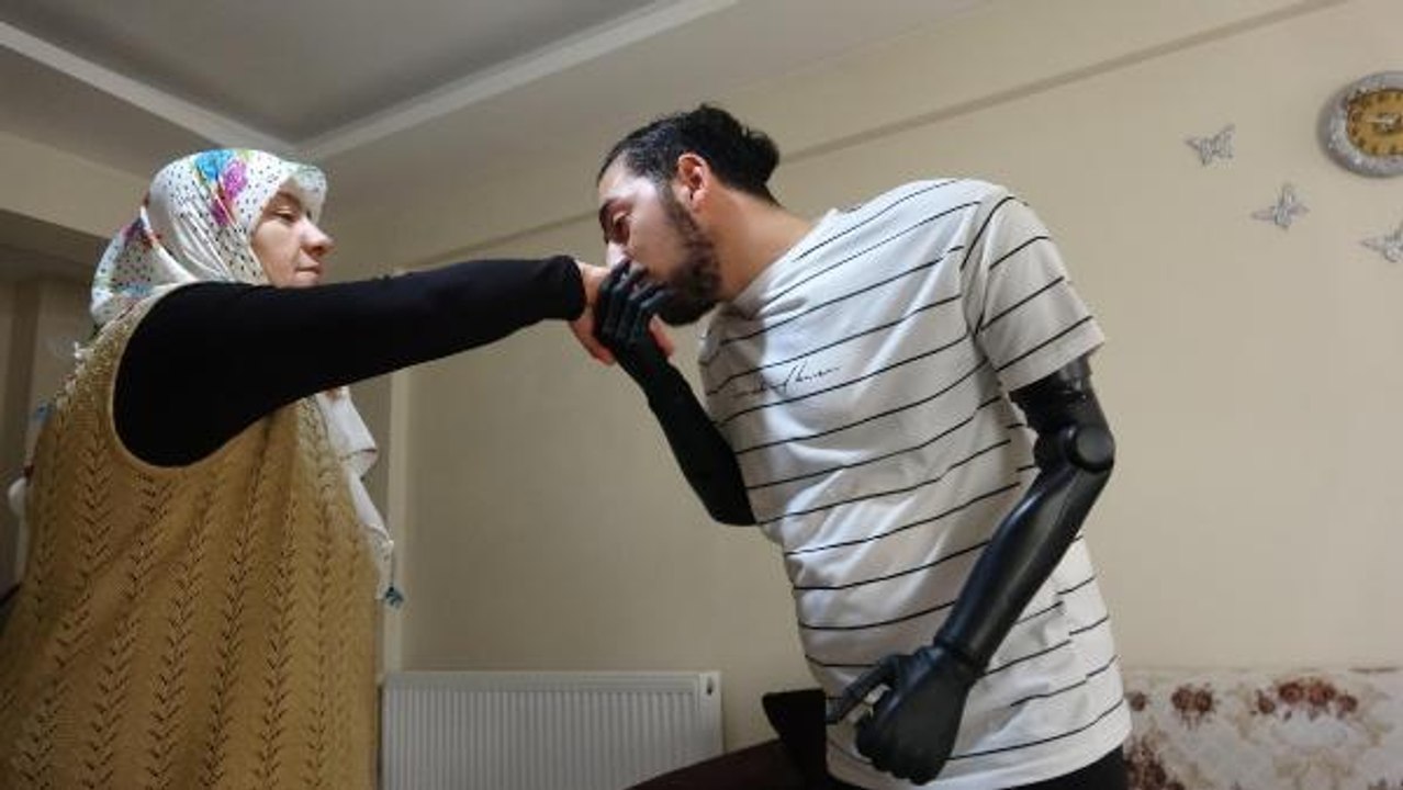 BİYONİK PROTEZ KOLLARINA KAVUŞAN SAMET, 20 AY SONRA ANNE VE BABASININ ELİNİ ÖPTÜ