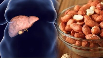 मूंगफली खाने से Liver Damage से लेकर Skin Allergy का खतरा, ये है वजह | Boldsky