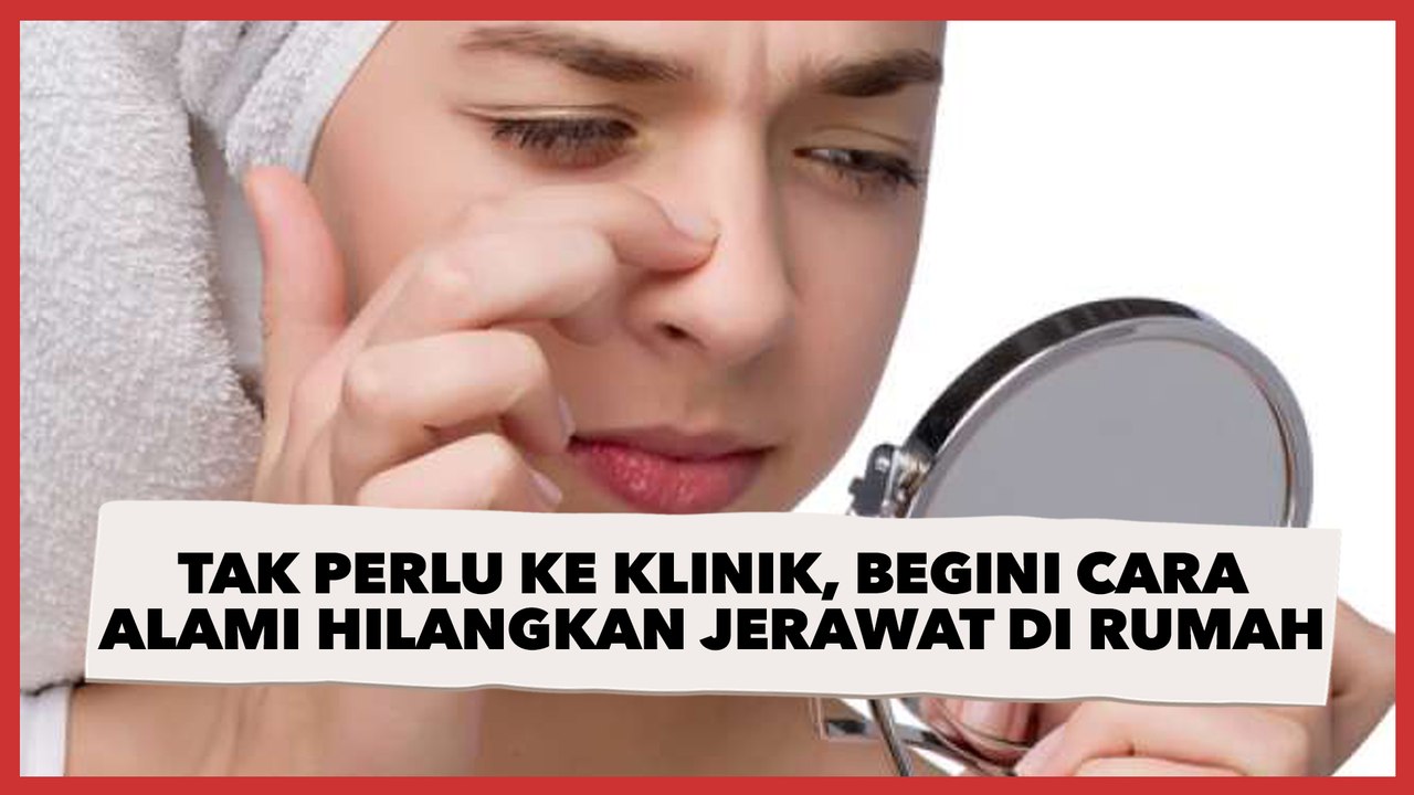 Tak Perlu ke Klinik, Begini Cara Alami Hilangkan Jerawat di Rumah