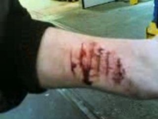 Flavio se coupe ds le bras