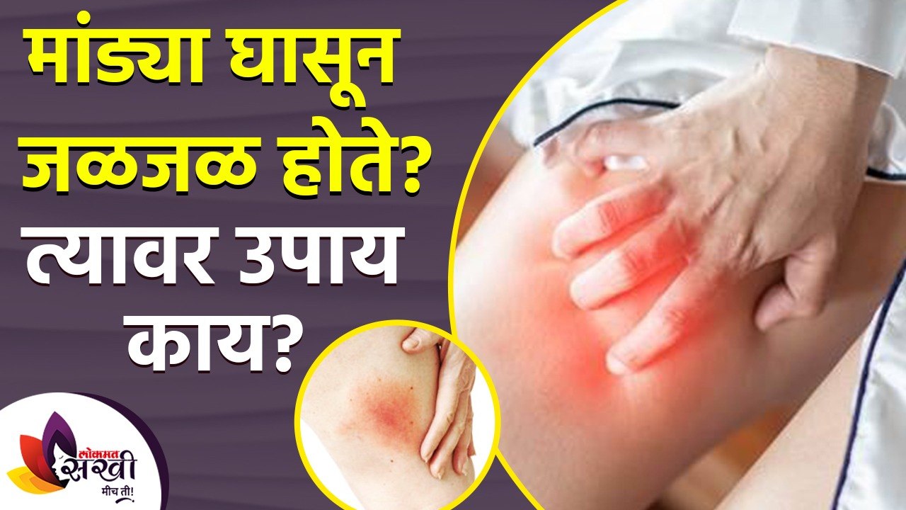 मांड्या घासून जळजळ होते? | How to Get Rid of It...