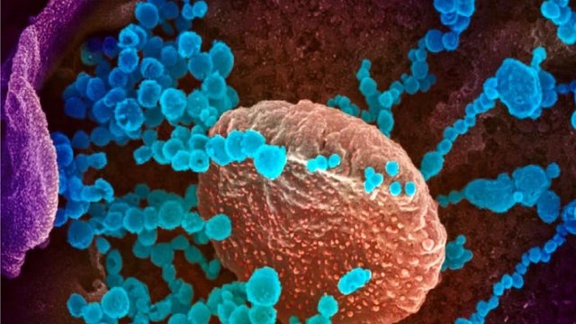 Omicron: IMA warns of 'massive third wave'