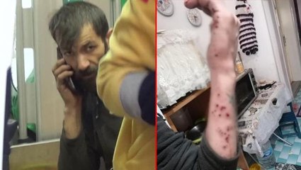 Hurdacı kabusu yaşadı! Topladığı malzemelerin arasından çıkan bomba fünyesi elinde patladı